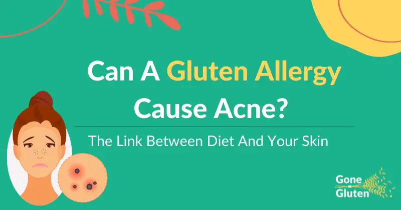 Can A Gluten Allergy Cause Acne [Currentyear]?